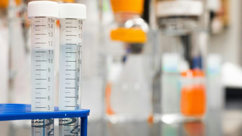 DNA GEL STAIN TEST